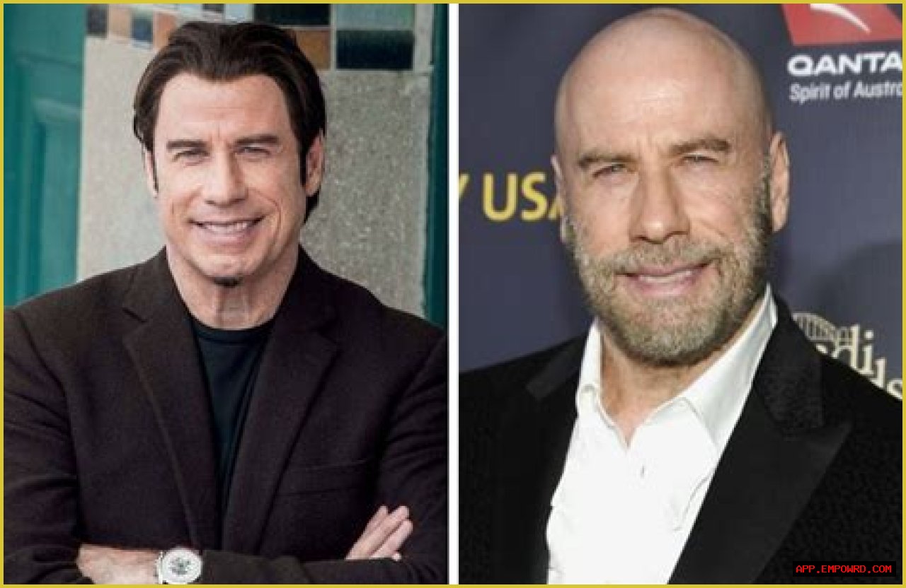 Bald Actors: Celebrating The Iconic Stars Who Embrace Their Hairless Looks