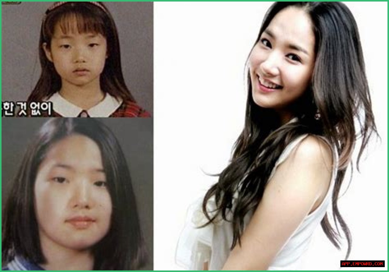 Park Min Young's Transformation: Uncovering The Journey Before Surgery